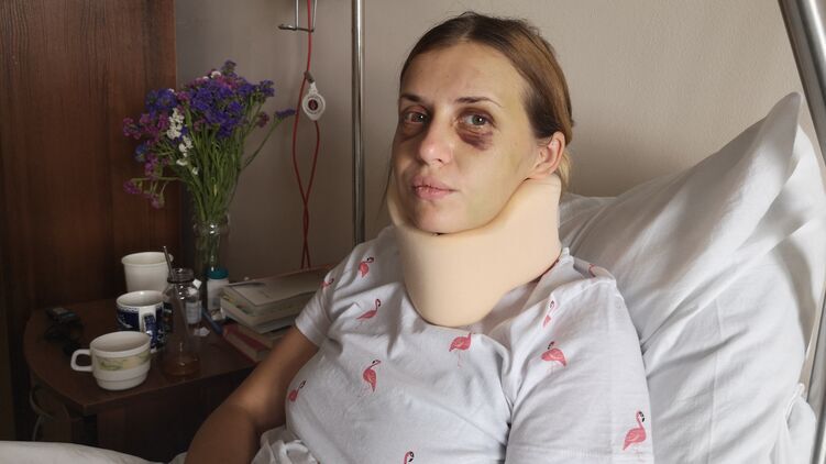 Анастасия Луговая, которую избили и попытались изнасиловать в поезде 