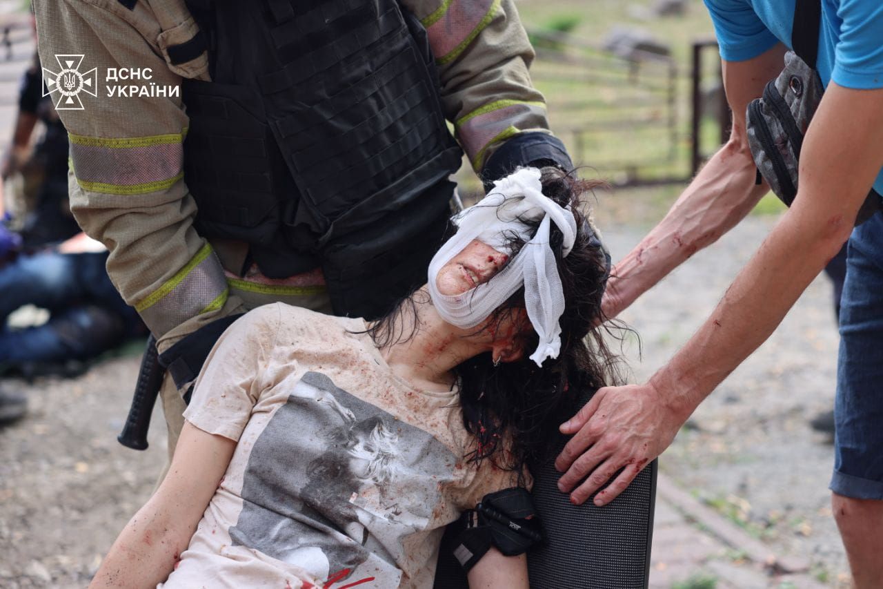 Фото постраждалої. Джерело - facebook.com/DSNS.GOV.UA/